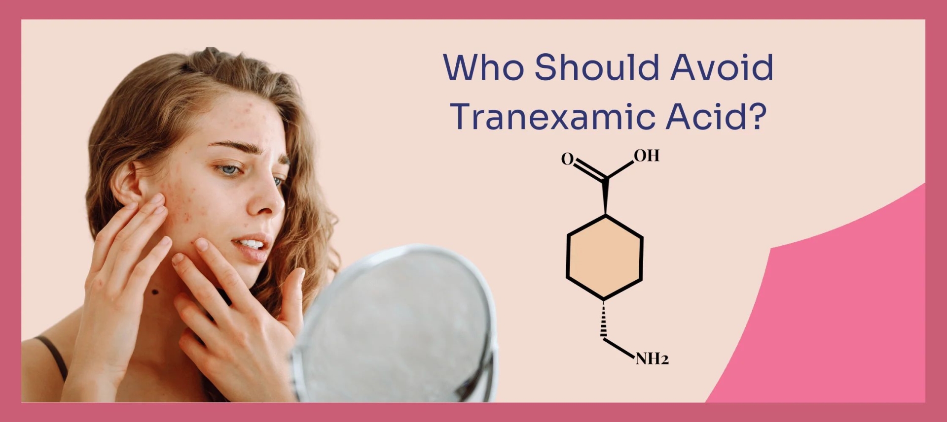 网红“氨甲环酸”被批准用于色斑治疗了吗？